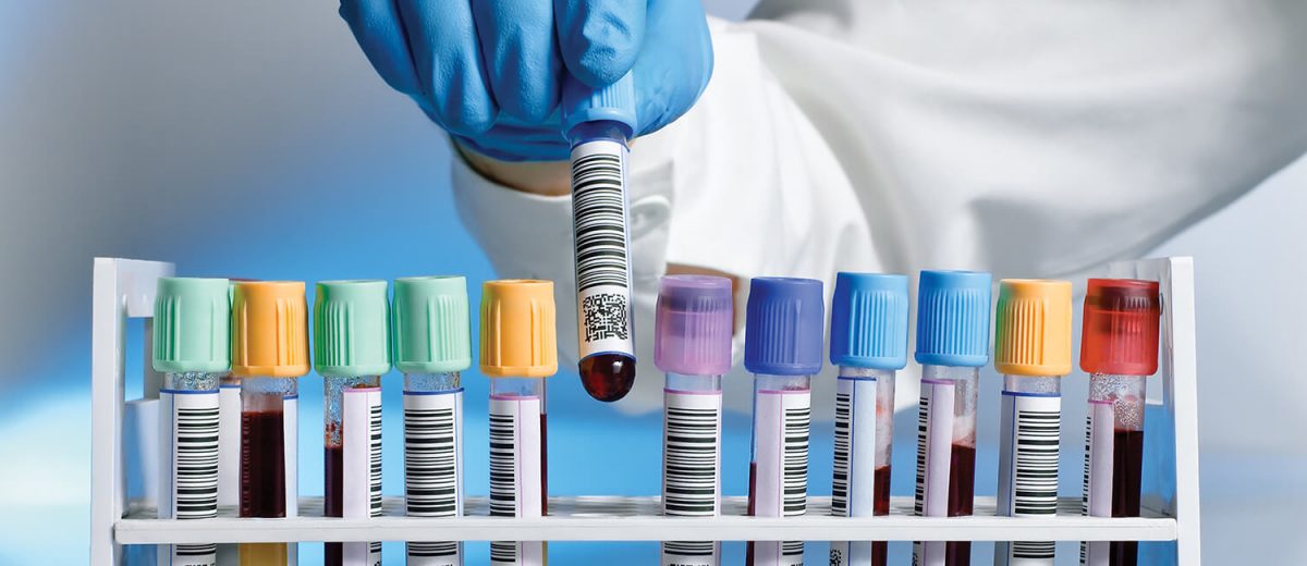 FSC  Medical Lab Technology - 2 Years